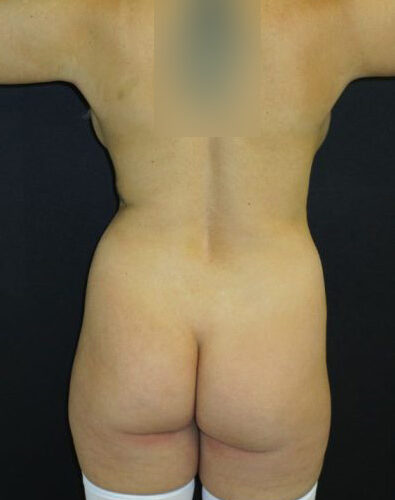 before_after_md-1057424-1600700-before-1602700544da8b6-420x560-1