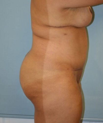 before_after_md-42138-1747357-after-16341603812cd00-420x631