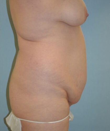 before_after_md-42138-1817067-before-1638989693c2a0f-420x632