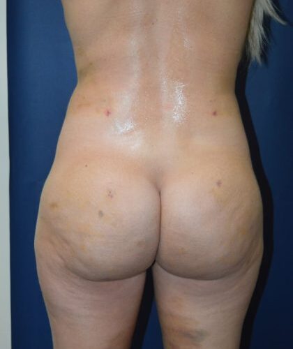 before_after_md-42138-1887718-after-1652201914eb309-420x631