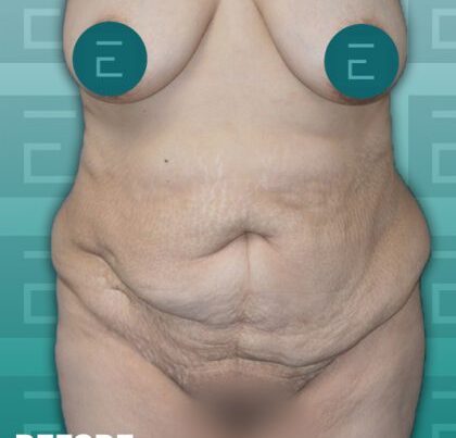 esth2-copy-420x476-1