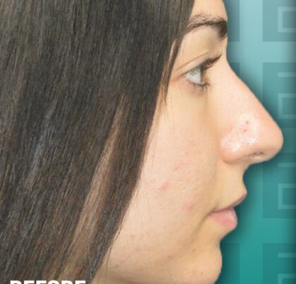 b42-copy-420x472