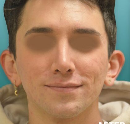ian1-420x471