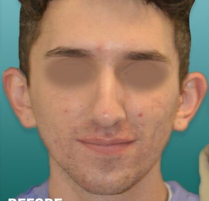 ian1-copy-420x475