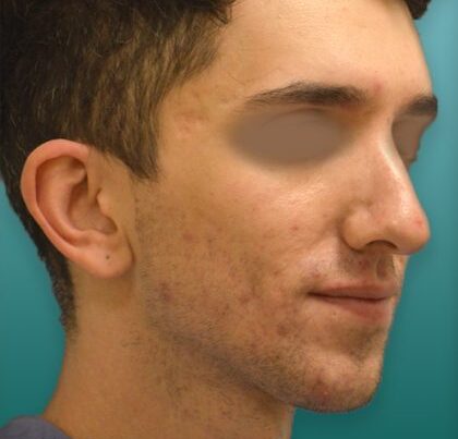 ian2-copy-420x490