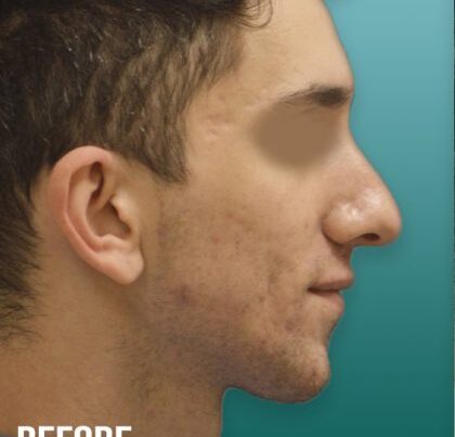 ian3-copy-420x463