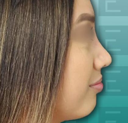 leslieBa1-420x491