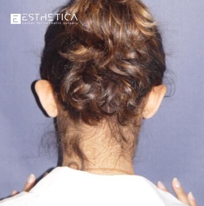 watermark-2